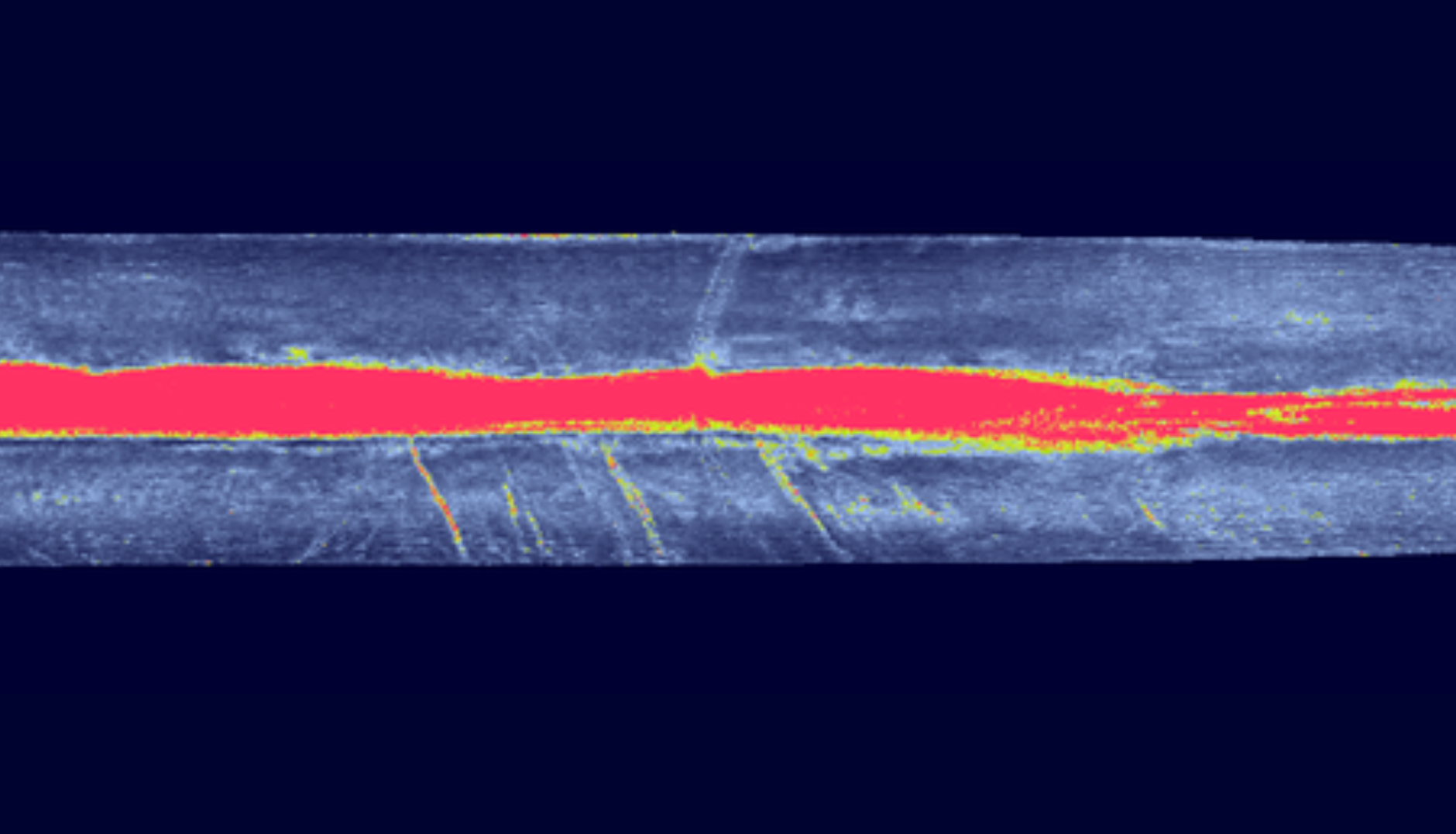 Longitudinal profile showing erosion point